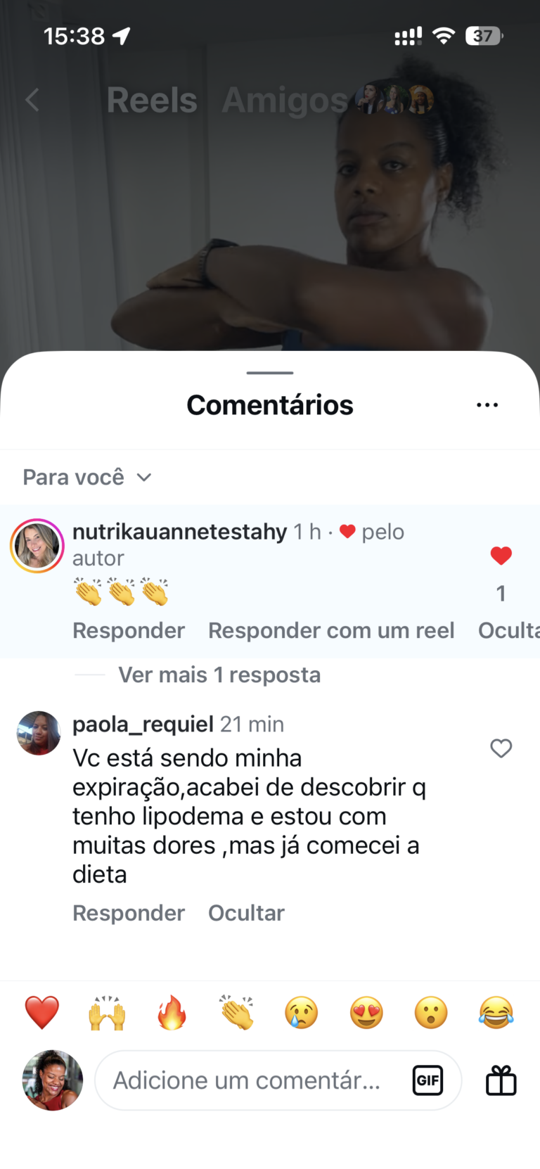 Comentário de seguidora relatando dor e dificuldades relacionadas ao lipedema após acompanhar o conteúdo da Luana Santinni.